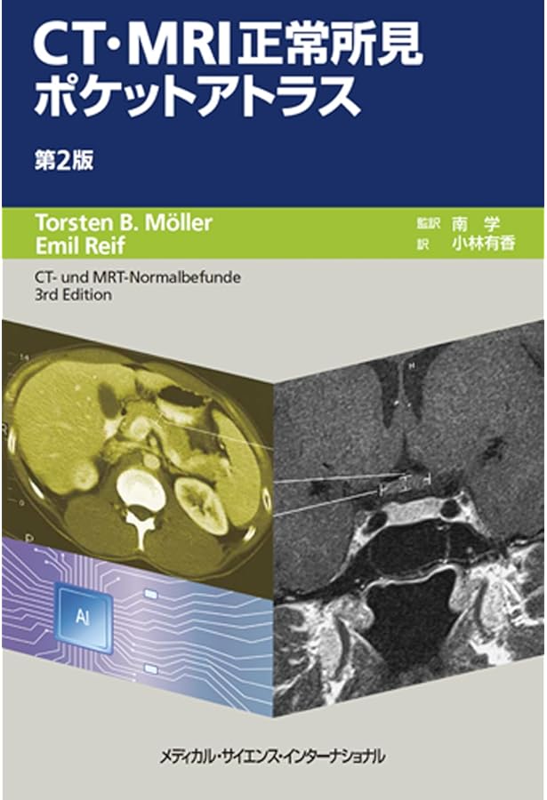 頭頸部画像診断に必要不可欠な臨床・画像解剖 | 尾尻博也, 尾尻博也